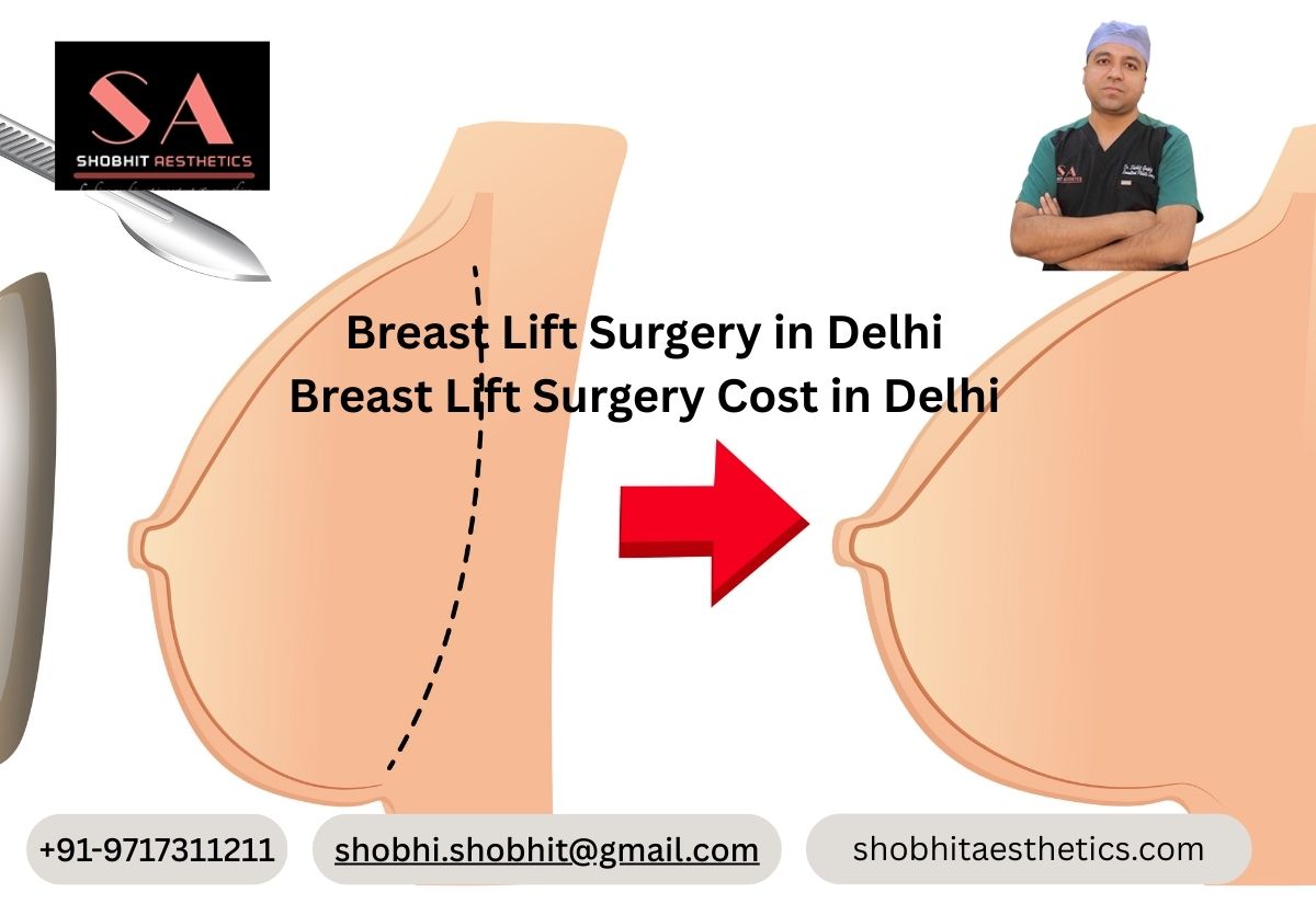 Breast Lift Surgery Cost in Delhi and India