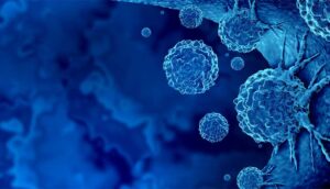 Cancer Immunotherapy