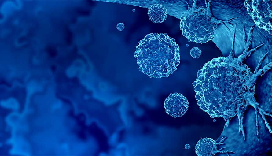 Cancer Immunotherapy