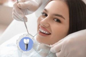 dental implant