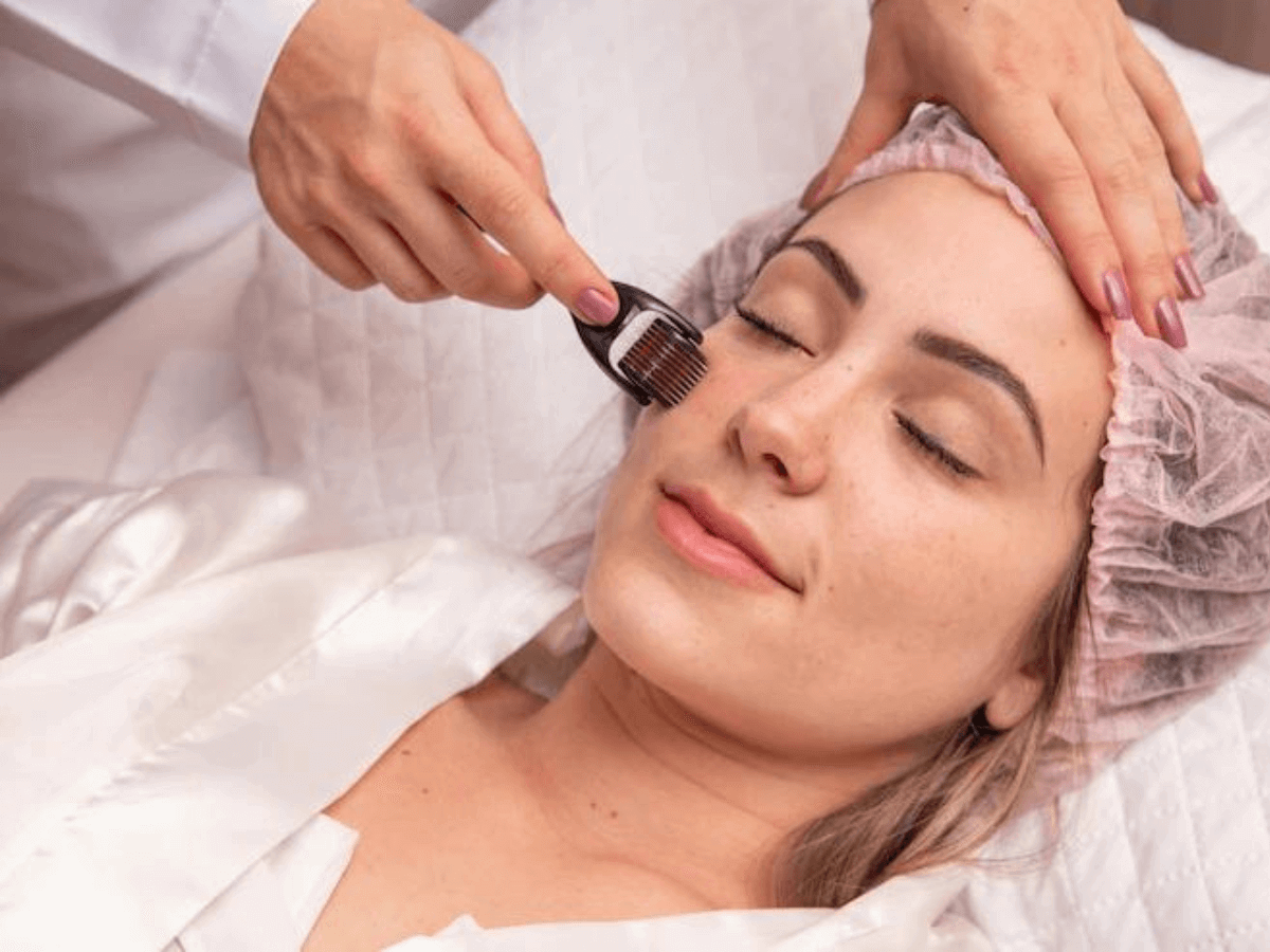 Dermaroller Treatment - Adore Skin Clinic