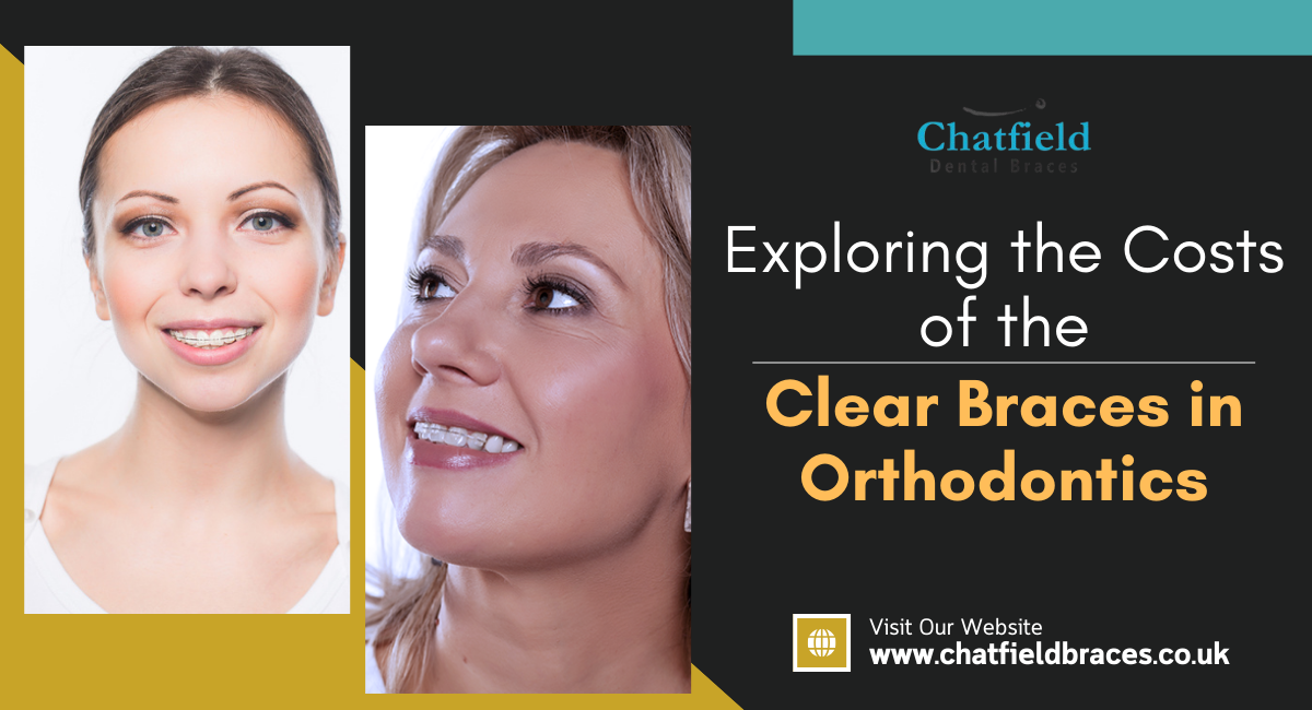 clear braces in London
