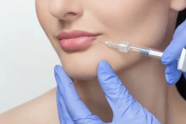 Could Lip Fillers in Richmond BC Boost Your Confidence Without Surgery?