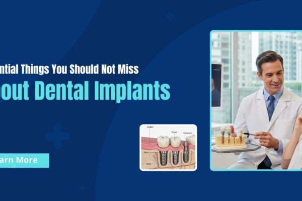 Essential Things You Should Not Miss About Dental Implants Affordable Dental Implants London